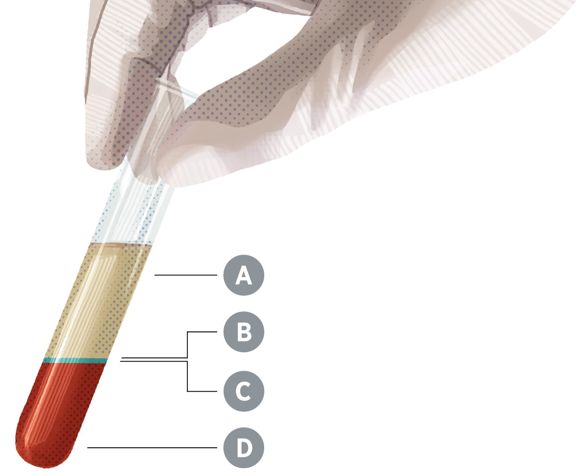 Image 3: A test tube containing blood separated into its four main components, which are labeled A, B, C, and D.