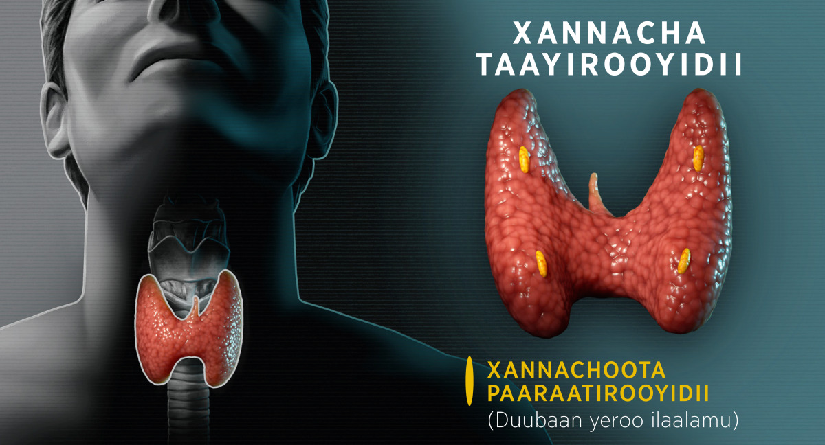 Kok rangli tor pantiesdagi qizlar erotik fotosuratlar